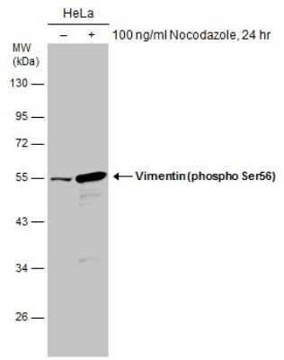 Western Blot: Vimentin [p Ser56] Antibody [NBP3-13119]